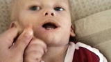 The Boy Who Bit Himself - Mystery Diagnosis Webisodes: Mystery Diagnosis: The Boy Who Bit Himself