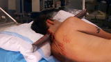 Untold Stories of the E.R.: There's a Pipe in My Head?