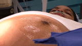 Pregnancy: Twins: C-section