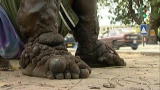 Monsters Inside Me: Elephantitis