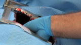 Untold Stories of the E.R. (Season 5): Drastic Measures