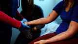 Mystery Diagnosis: The Girl with the Strange Bumps