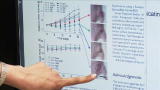 Dean of Invention: How Microbots Can Eliminate Tumors