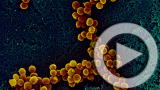 Planet 100: Microbes Come to the Rescue in the Gulf