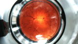 Dean of Invention: Can Microscopic Robots Cure Blindness?