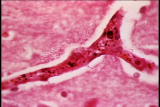 Assignment Discovery Shorts: Bacteria Changes