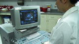 Physician Ed: Myocardial Perfusion Imaging