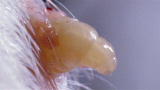 Nasty By Nature: Botfly Larvae