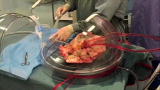 Is It Possible: Out of Body Lung