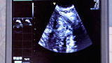 Curiosity: Ultrasound