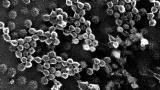 Human: H1N1 Swine Flu: A Look Inside