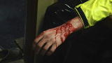 Deadliest Catch: Wounded!