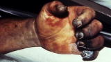 Filthy Cities: Black Death