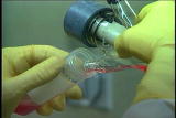 Assignment Discovery Shorts: Carticel Cartilage Implant