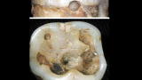 Why? Tell Me Why!: Wisdom Teeth