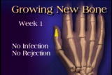 Assignment Discovery Shorts: Regrow Bones