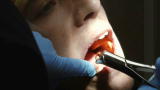 After The Catch 5: Dental Toughness