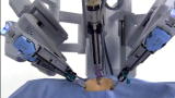 Physician Ed: Whipple Procedure for Pancreatic Surgery