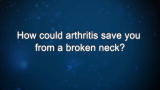 Curiosity: Stephen Tobolowsky: Arthritis and a Broken Neck