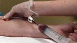Physician Ed: Platelet Rich Plasma Therapy