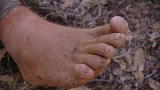 Dual Survival: Cody's Pedicure