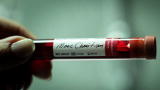 The Will: Superior Court Hears AIDS Case