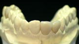 How It's Made: Dental Crowns