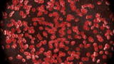 Greatest Discoveries: The Beginning of Blood Transfusions