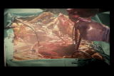 Zombies: Brain Transplants