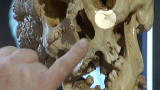 Skeleton