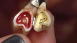Oddities: Tooth Locket