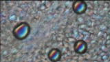 100 Greatest Discoveries: Germ Theory Origins