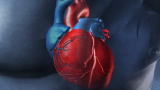 Brink: Treating Heart Disease