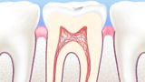 What Are the Odds?: Cavity