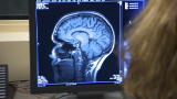 Ingenious Minds: Diffusion Spectrum Imaging