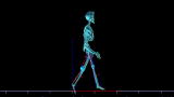 Elephant Man Autopsy: Skeleton Scan