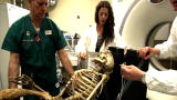 Elephant Man Autopsy: Model 3D