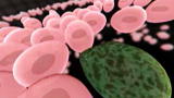 Greatest Discoveries: Cancer Theories and Discoveries