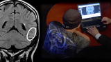 Ingenious Minds: Brain Scan of a Savant