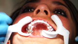 Brink: Robotic Braces