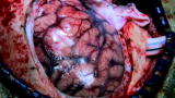 Through the Wormhole 2: Final Destination for the Soul