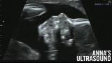 Duggars The Next Generation: Anna's Ultrasound