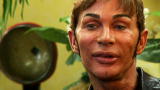 Truth Be Told Clips: Steve's Plastic Surgery Addiction