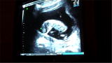 A Conception Story: Amber's First Baby Photos