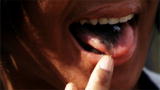 My Strange Addiction: Eating Cigarette Ashes