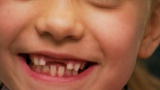 Toddlers & Tiaras: Toothless Grin