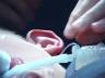 Body Work:  Ear Surgery