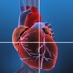 Health Issues with Dr. Oz: CAD and Heart Attacks