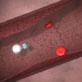 Body Invaders: Rheumatoid Arthritis