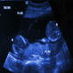 Baby Week: Amazing Births, Part 1